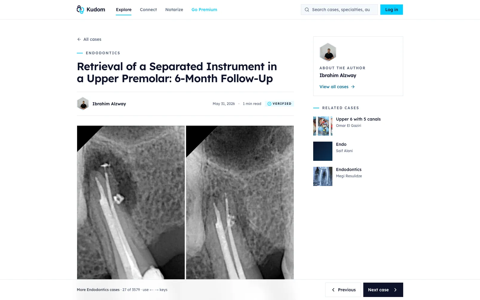 A case page on the new Kudom