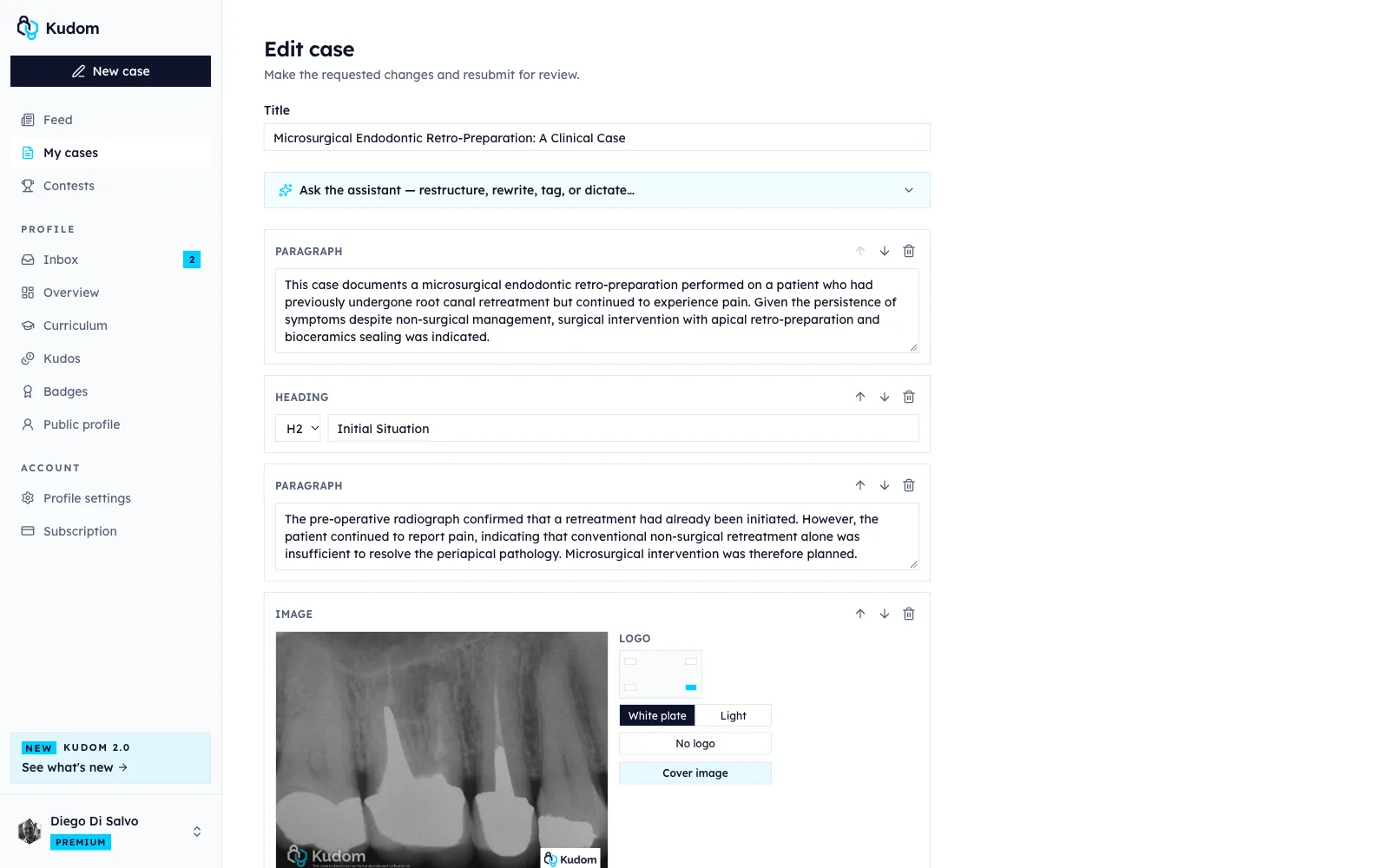The new case editor with the AI assistant